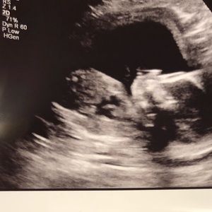 Meet your Posher, Bethania